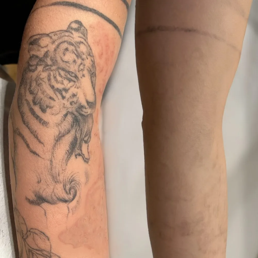 Tetovanie tigra na lýtku pred zosvetlením a po ňom