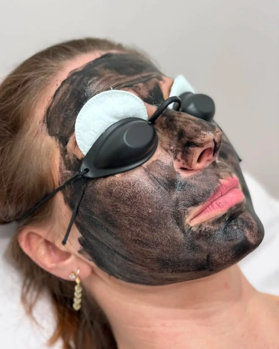 Carbon Facial, Starostlivosť o pleť